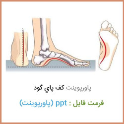 دانلود فایل پاورپوینت كف پای گود Cavus foot دانلود فایل پاورپوینت كف پای گود Cavus foot