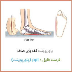 دانلود فایل پاورپوینت کف پای صاف Flat foot دانلود فایل پاورپوینت کف پای صاف Flat foot