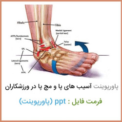 پاورپوینت آسیب های پا و مچ پا در ورزشکاران پاورپوینت آسیب های پا و مچ پا در ورزشکاران