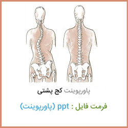 دانلود فایل پاورپوینت کج پشتی scoliosis دانلود فایل پاورپوینت کج پشتی scoliosis