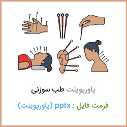 دانلود فایل پاورپوینت طب سوزنی acupuncture دانلود فایل پاورپوینت طب سوزنی acupuncture