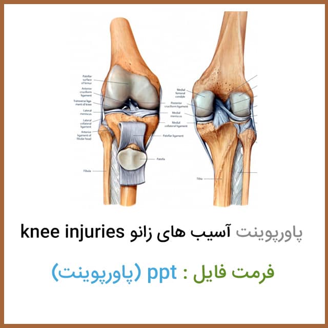 فایل پاورپوینت آسیب های زانو knee injuries